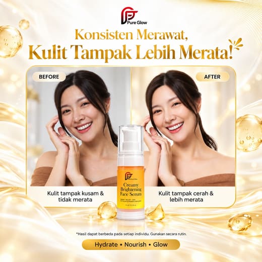 Ilustrasi sebelum & sesudah rutin memakai Face Serum