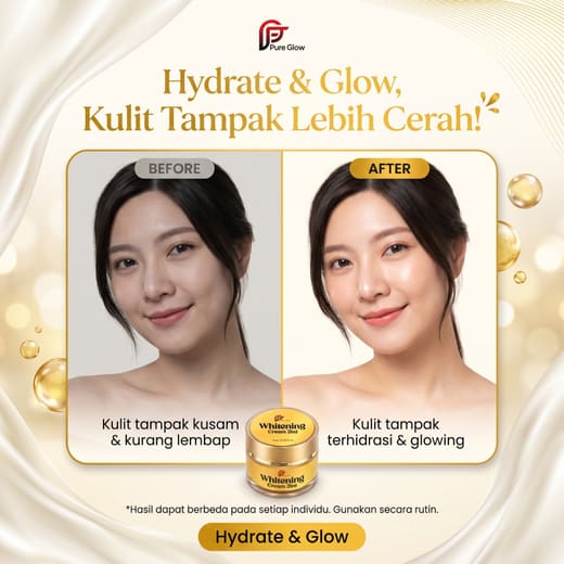 Ilustrasi sebelum & sesudah rutin memakai Whitening Cream 2in1